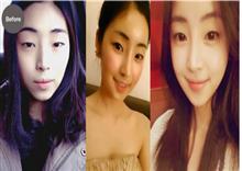 ១៥ សន្លឹក ស្តីពីការវះកាត់ កែសម្ភស្ស នៅកូរ៉េ 