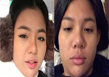 ស្មានថាលើកទីមួយ! ការពិត កញ្ញា​ ធី សុវណ្ណថា ទៅវះកាត់កែសម្ជស្សនៅប្រទេសកូរ៉េ មិនមែនតែម្តងទេ