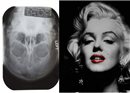 គ្រាន់តែរួប X-Rays របស់ស្រីស្អាតជំនាន់មុន Marilyn Manroe មានគេអោយថ្លៃដល់ទៅ ២៥០០០ ដុល្លារ