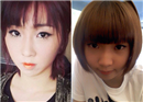 Minzy (2NE1) ទទួលស្គាល់ថា នាងពិតជាបាន ធ្វើការវះកាត់កែសម្ផស្សមែន