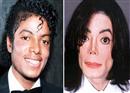 អាថ៌កំបាំង នៅពីក្រោយការចាក់ថ្នាំ ឲ្យស្បែកសខុសធម្មជាតិ របស់ស្តេចចម្រៀងប៉ុប «Michael Jackson»